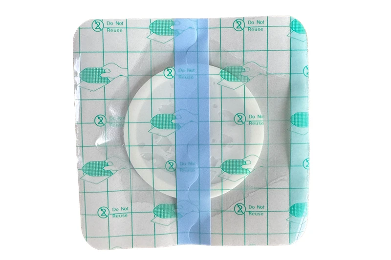 Top Features Procurement Teams Look for in Island Wound Dressings