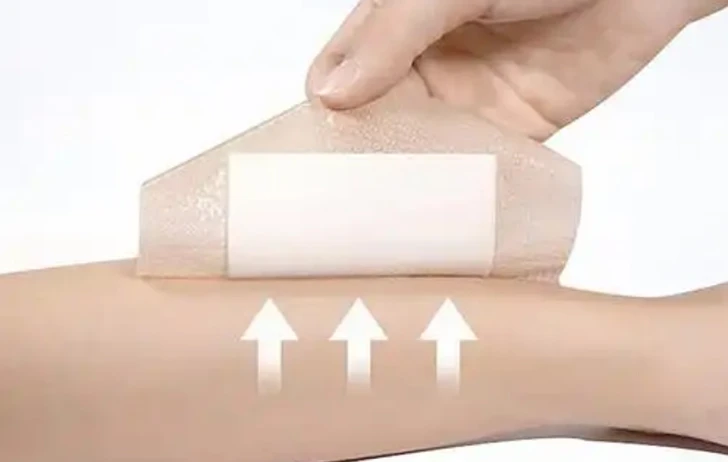 Zhuopu Medical Successfully Participates in International Wound Care Exhibitions 2026 &ndash; Strengthening Global Partnerships for OEM Wound Dressings
