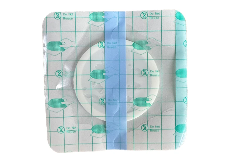 High Absorbency Non-Woven Island Wound Dressing